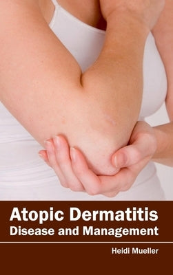 Atopic Dermatitis: Disease and Management by Mueller, Heidi