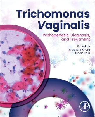 Trichomonas Vaginalis: Pathogenesis, Diagnosis, and Treatment by Khare, Prashant