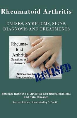 Rheumatoid Arthritis: Causes, Symptoms, Signs, Diagnosis and Treatments - Revised Edition - Illustrated by S. Smith by Smith, S.
