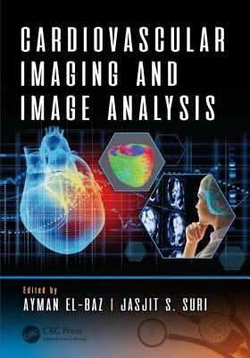 Cardiovascular Imaging and Image Analysis by El-Baz, Ayman