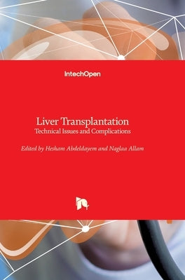 Liver Transplantation: Technical Issues and Complications by Allam, Naglaa