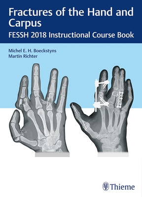 Fractures of the Hand and Carpus: Fessh 2018 Instructional Course Book by Boeckstyns, Michel E. H.