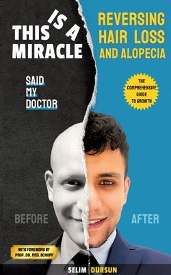 This Is a Miracle Said My Doctor: Reversing Hair Loss and Alopecia by Dursun, Selim
