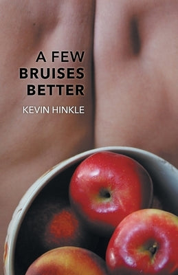 A Few Bruises Better by Hinkle, Kevin