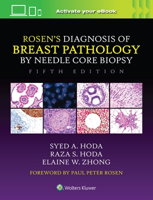 Rosen's Diagnosis of Breast Pathology by Needle Core Biopsy by Hoda, Syed A.