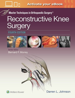 Master Techniques in Orthopaedic Surgery: Reconstructive Knee Surgery by Johnson, Darren L.