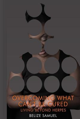 Overcoming What Can't be Cured: Living Beyond Herpes by Samuel, Belize