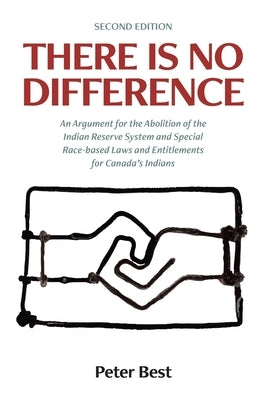 There Is No Difference: An Argument for the Abolition of the Indian Reserve System and Special Race-based Laws and Entitlements for Canada's I by Best, Peter
