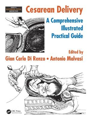 Cesarean Delivery: A Comprehensive Illustrated Practical Guide by Di Renzo, Gian Carlo