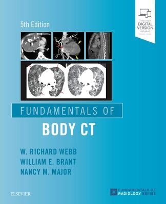 Fundamentals of Body CT by Webb, W. Richard