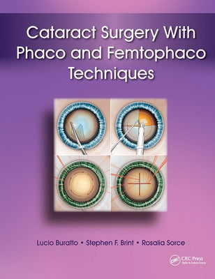 Cataract Surgery With Phaco and Femtophaco Techniques by Buratto, Lucio