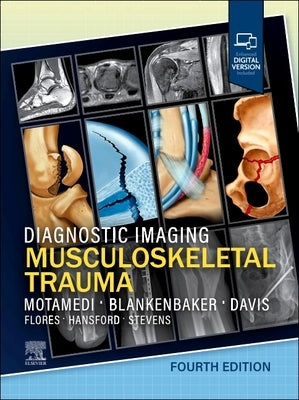 Diagnostic Imaging: Musculoskeletal Trauma by Motamedi, Kambiz