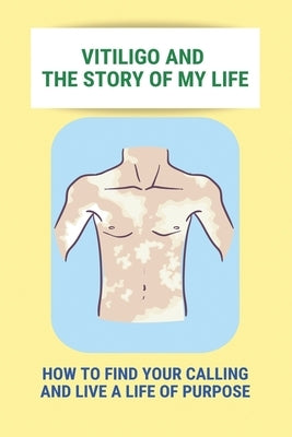 Vitiligo And The Story Of My Life: How To Find Your Calling And Live A Life Of Purpose: Vitiligo Social Stigma by Goodaker, Deandre
