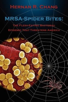 MRSA - Spider Bites: The Flesh-Eating Bacterial Epidemic That Threatens America by Chang, Hernan R.