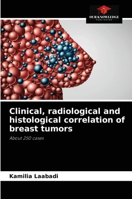 Clinical, radiological and histological correlation of breast tumors by Laabadi, Kamilia