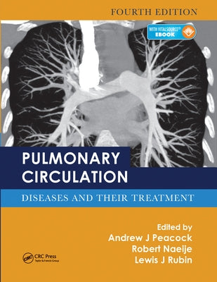 Pulmonary Circulation: Diseases and Their Treatment, Fourth Edition by Peacock, Andrew J.