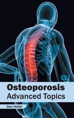 Osteoporosis: Advanced Topics by Heller, Dan