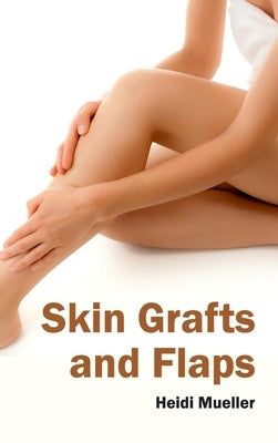 Skin Grafts and Flaps by Mueller, Heidi