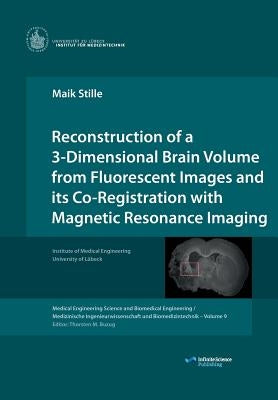 Reconstruction of a 3-Dimensional Brain Volume from Fluorescent Images and its Co-Registration with Magnetic Resonance Imaging by Stille, Maik
