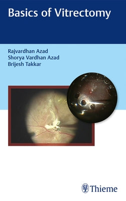 Basics of Vitrectomy by 