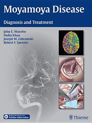 Moyamoya Disease: Diagnosis and Treatment by Wanebo, John E.