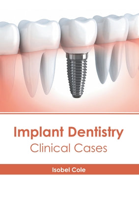 Implant Dentistry: Clinical Cases by Cole, Isobel