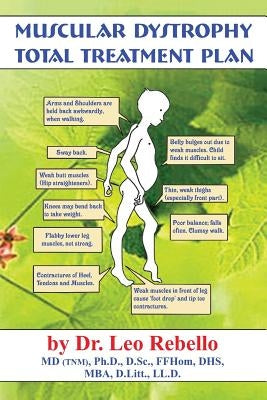Muscular Dystrophy: Total Treatment Plan by Rebello, Leo