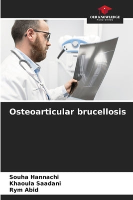Osteoarticular brucellosis by Hannachi, Souha