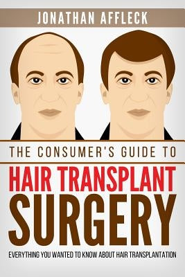 The Consumer's Guide to Hair Transplant Surgery: Everything You Wanted to Know About Hair Transplantation by Affleck, Jonathan