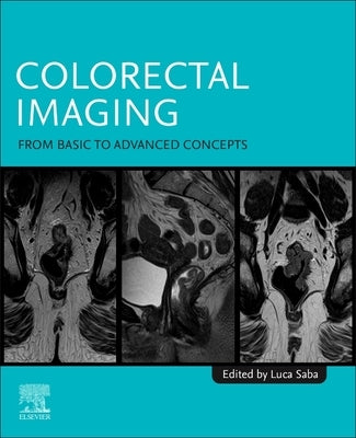 Colorectal Imaging: From Basic to Advanced Concepts by Saba, Luca