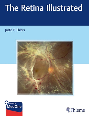 The Retina Illustrated by Ehlers, Justis P.