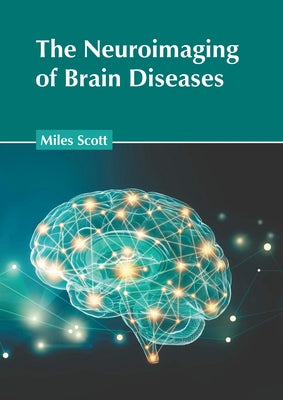 The Neuroimaging of Brain Diseases by Scott, Miles