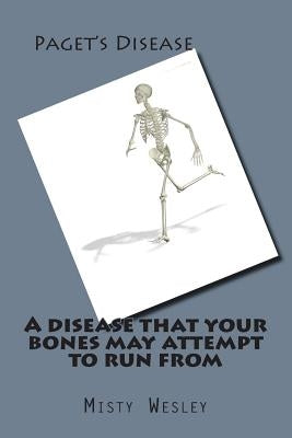 A disease that your bones may attempt to run from by Wesley, Misty Lynn