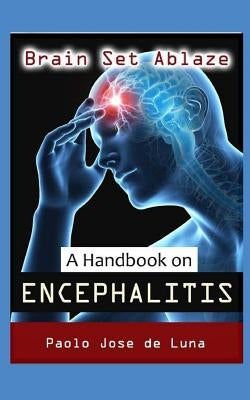 Brain Set Ablaze: A Handbook on Encephalitis by Jose De Luna, Paolo