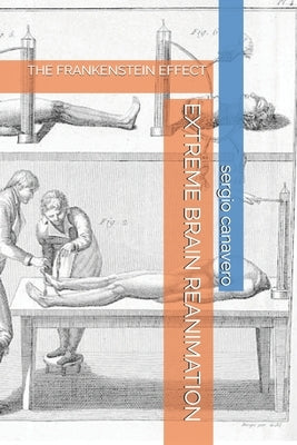 Extreme Brain Reanimation: The Frankenstein Effect by Canavero, Sergio