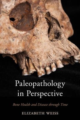 Paleopathology in Perspective: Bone Health and Disease Through Time by Weiss, Elizabeth