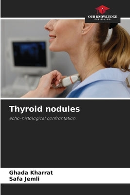 Thyroid nodules by Kharrat, Ghada