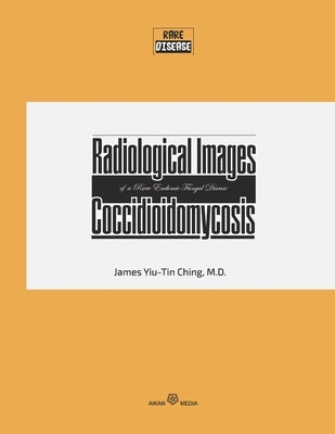 Radiological Images of a Rare Endemic Fungal Disease Coccidioidomycosis by Ching, James Yiu Tin