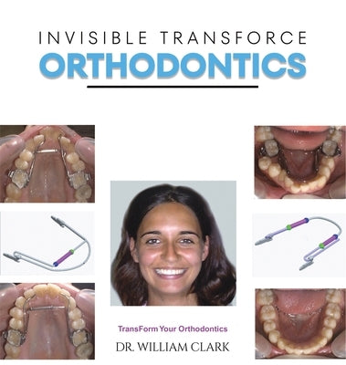 Invisible TransForce Orthodontics by Clark, William