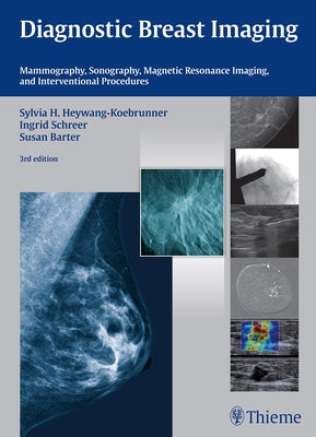Diagnostic Breast Imaging: Mammography, Sonography, MRI and Interventional Procedures by Heywang-Köbrunner, Sylvia H.