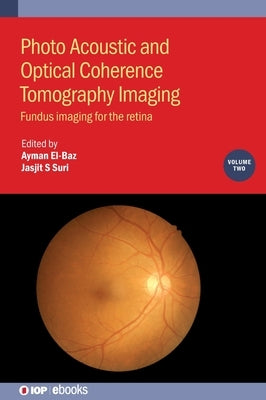 Photo Acoustic and Optical Coherence Tomography Imaging, Volume 2: Fundus imaging for the retina by El-Baz, Ayman