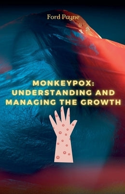 Monkeypox: Understanding And Managing The Growth by Payne, Ford