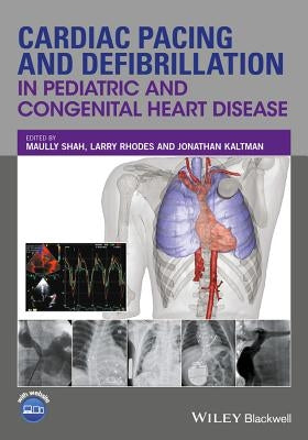 Cardiac Pacing and Defibrillation in Pediatric and Congenital Heart Disease by Shah, Maully