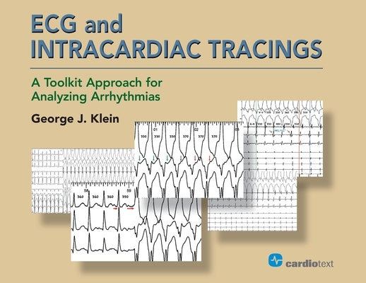 ECG and Intracardiac Tracings: A Toolkit Approach for Analyzing Arrhythmias by Klein, George J.