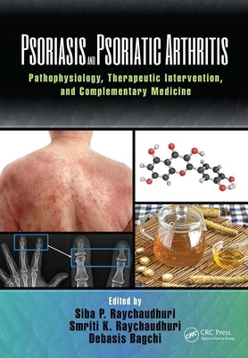 Psoriasis and Psoriatic Arthritis: Pathophysiology, Therapeutic Intervention, and Complementary Medicine by Raychaudhuri, Siba P.