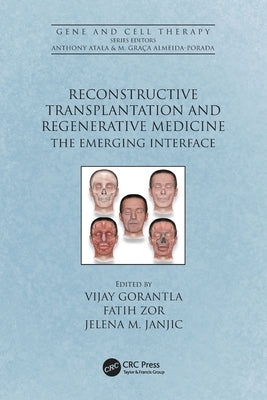 Reconstructive Transplantation and Regenerative Medicine: The Emerging Interface by Gorantla, Vijay