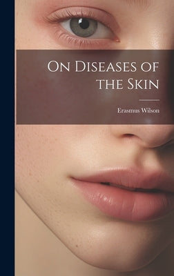 On Diseases of the Skin by Wilson, Erasmus