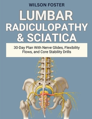 Lumbar Radiculopathy & Sciatica: 30-Day Plan With Nerve Glides, Flexibility Flows, and Core Stability Drills by Foster, Wilson