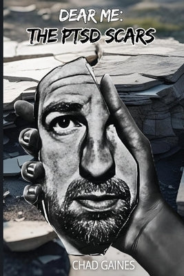Dear Me: The PTSD Scars by Gaines, Chad