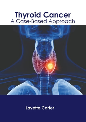 Thyroid Cancer: A Case-Based Approach by Carter, Lavette
